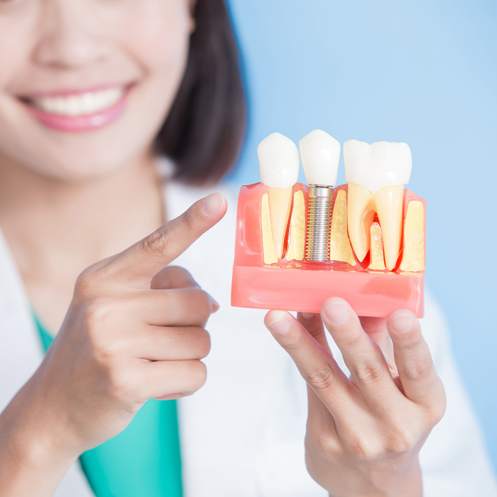 The image shows a woman in a white lab coat holding up a model of a tooth with a filling and a dental implant, pointing at it with her index finger.