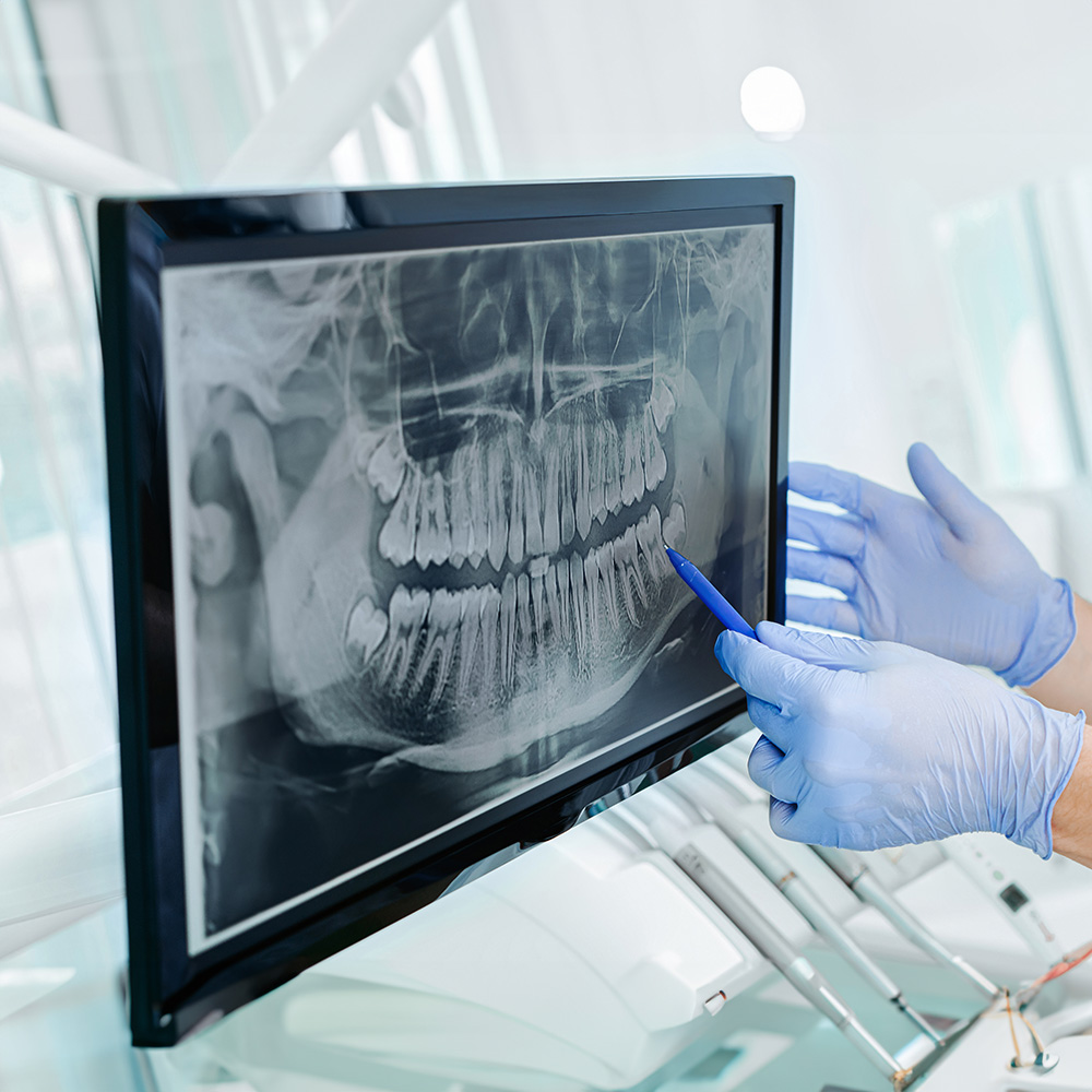 A dental professional examines an X-ray of teeth using a magnifying glass with gloves on.