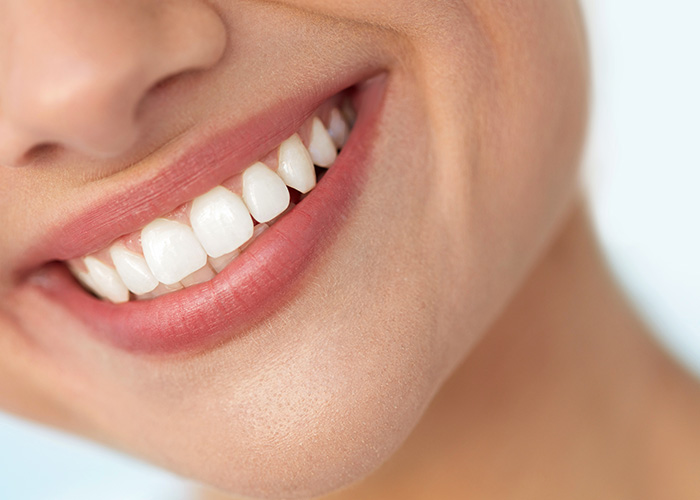 The image shows a close-up of a person's smiling face with teeth, presenting a positive expression.